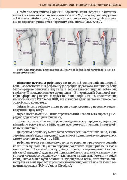 Ультразвукова Флебологія 9789655975741 фото