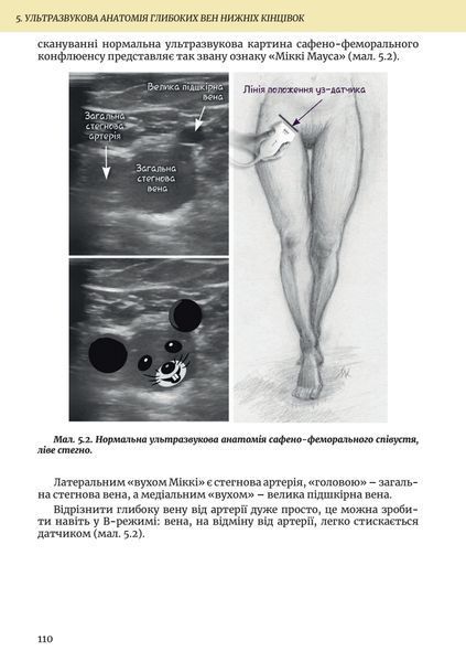 Ультразвукова Флебологія 9789655975741 фото